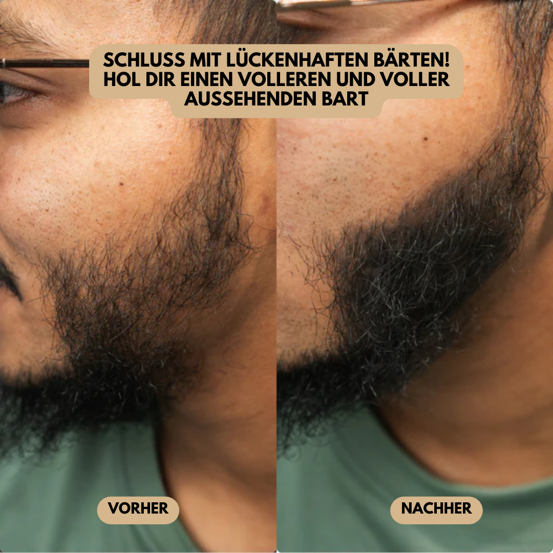 MagicPowder | die schnellste Lösung für lichtes Haar