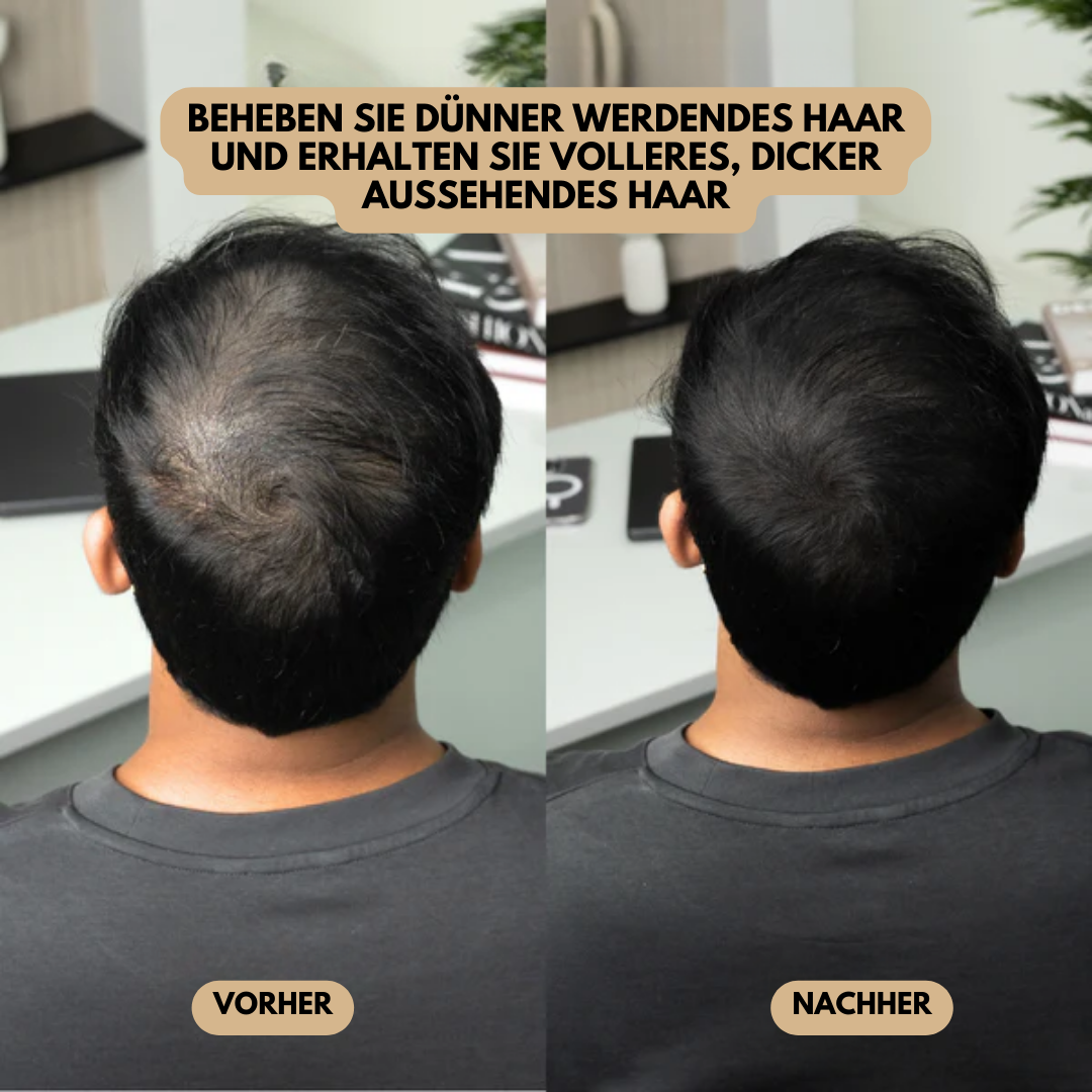 MagicPowder | die schnellste Lösung für lichtes Haar